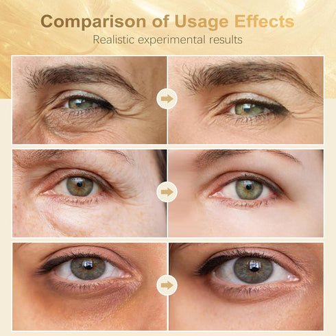 Under Eye Patches (60 Pcs) - 24K Gold Eye Masks for Dark Circles and Puffiness, Eye Patches for Puffy Eyes, Anti-Aging Hyaluronic Acid Moisturizin...