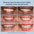 Auraglow Teeth Whitening Strips, Sensitive Whitening Strips, 14 Whitening Treatments, 8% Hydrogen Peroxide with Nano Hydroxyapatite (nHAp) to Redu...