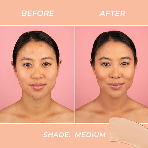 MCoBeauty Miracle BB Cream - Perfects And Corrects Skin - Covers Imperfections - Lightweight And Buildable Coverage - Delivers Extra Hydration - F...