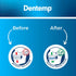 Dentemp Ora-Guard Custom Fit Dental Guard - Bruxism Night Guard for Teeth Grinding - Mouth Guard for Clenching Teeth at Night - Comfortable Mouth ...