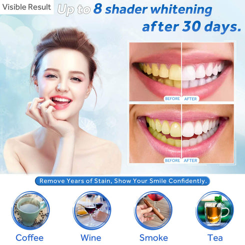 EZGO 10 Pack Teeth Whitening Gel Refills 22% Bleaching Gel, No Sensitive Teeth Whitener, Great for Sensitive Tooth Whitening, Carbamide Peroxide T...