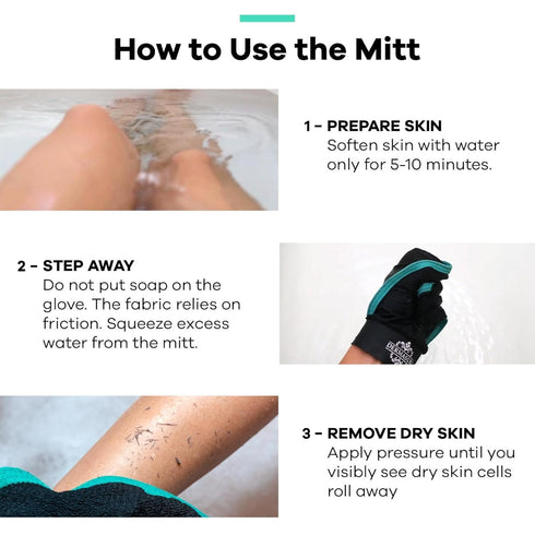 Dermasuri Deep Exfoliating Glove for Shower - Exfoliating Mitt Body Scrubber - Skin Exfoliator & Dead Skin Remover - Keratosis Pilaris Scrub - Spr...