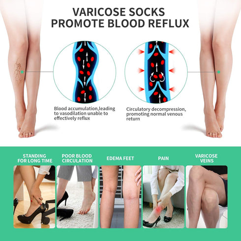 Compression Pantyhose 20-30mmHg Tight Stocking Gradient Compression Hose Help Relieve Swelling Edema Varicose Veins for Women Opaque Closed Toe Fi...
