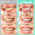 200 PCS Interdental Brushes, Dental Braces Floss Picks for Teeth Cleaning with Soft and Bendable Bristles Efficient Orthodontic Braces Oral Care T...