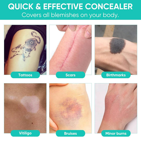 Tattoo Cover Up Tape, Ultra Thin Patch for Tattoo Scar and Birthmarks, Invisible Waterproof Skin Tone Concealer Sticker, Ultra Thin Patch for Tatt...