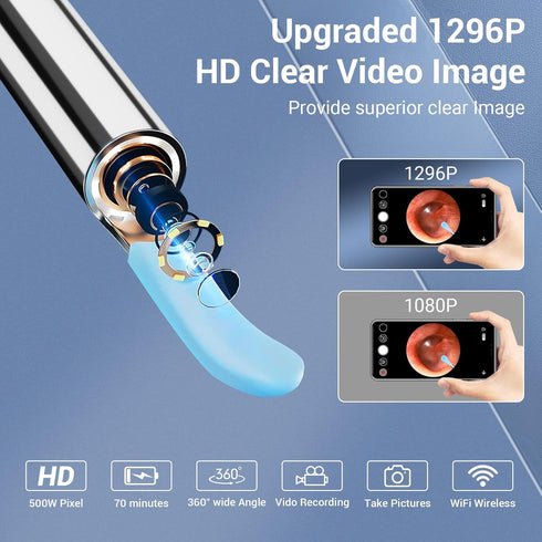 Ear Wax Removal, Ear Cleaner Camera with 1296HD, Ear Wax Removal Kit with 8 Pcs Ear Cleaning Tools, Ear Camera with 6 LED Lights, Ear Cleaner for ...