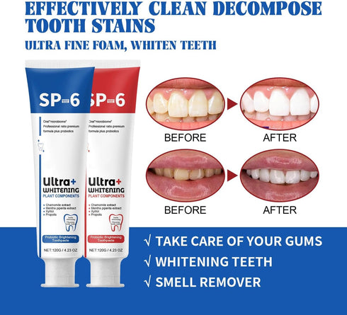2Pc Sp-6 Ultra Whitening,Sp 6 Toothpaste,Super Probiotic-6 Toothpaste,Ultra Whitening Toothpaste Sp-6,Probiotic Brightening Toothpaste,Deep Cleani...