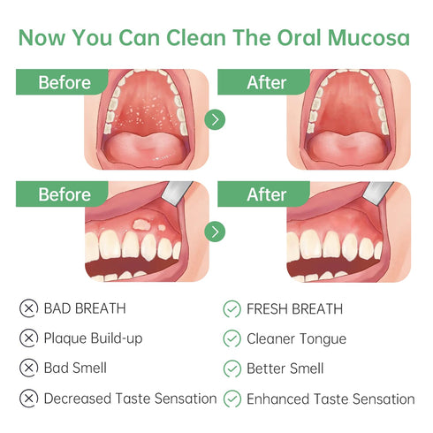 Oral Mucosal Cleaner|Silicon Oral Care Cleaner|Gum Massager with Air Bag(1 pc)...