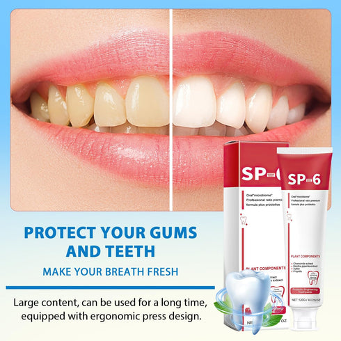 2PCS Sp-6 Ultra Whitening, Sp-6 Probiotic Whitening Toothpaste, Ultra Whitening Toothpaste sp6, Probiotic Brightening Toothpaste,Deep Cleaning Car...