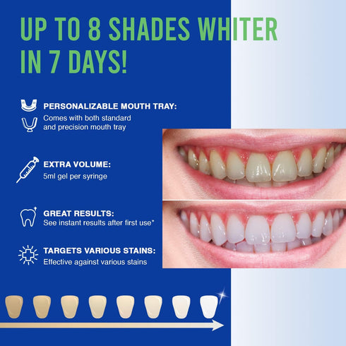 VieBeauti Teeth Whitening Kit - 5X LED Light Tooth Whitener with 35% Carbamide Peroxide, Mouth Trays, Remineralizing Gel and Tray Case - Built-in ...