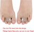 8 Pieces Toe Splint Wraps Non Slip Hammer Toe Straightener for Broken Toe, Crooked, Overlapped, and Hammer Toes-Women and Men...