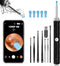 Ear Wax Removal, Ear Cleaner with Camera and Light, Ear Wax Removal Kit with 1296P Otoscope, Ear Cleaning Tool with 6 Ear Spoon, Ear Camera for iP...