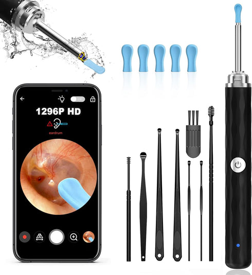 Ear Wax Removal, Ear Cleaner with Camera and Light, Ear Wax Removal Kit with 1296P Otoscope, Ear Cleaning Tool with 6 Ear Spoon, Ear Camera for iP...