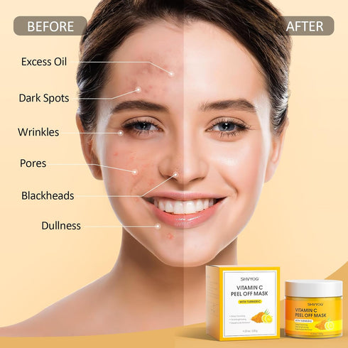 SHVYOG Vitamin C Peel Off Face Mask, Peel Off Mask with Turmeric, Blackhead Remover & Deep Cleansing Face Peel Mask, Vitamin C Exfoliating Face Ma...