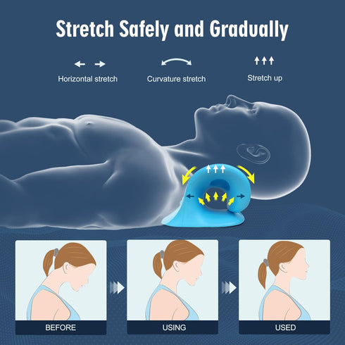 Neck Stretcher for Pain Relief, Neck and Shoulder Relaxer Cervical Traction Device Pillow for Muscle Relax and TMJ Pain Relief (Blue)...