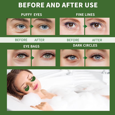 Under Eye Patches for Puffy Eyes 70PCS, Seaweed Eye Mask for Dark Circles and Puffiness, Under Eye Mask Patches Skincare, Eye Gel Pads, Eye Patche...