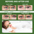 Under Eye Patches for Puffy Eyes 70PCS, Seaweed Eye Mask for Dark Circles and Puffiness, Under Eye Mask Patches Skincare, Eye Gel Pads, Eye Patche...
