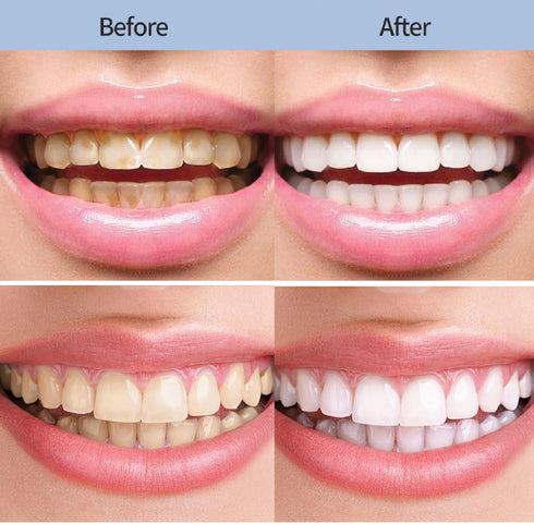 2Pcs Niacinamide Whitening Toothpaste, Nicotinamide Toothpaste, Fresh Breath Toothpaste, Remove Tooth Stains....