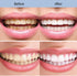 2Pcs Niacinamide Whitening Toothpaste, Nicotinamide Toothpaste, Fresh Breath Toothpaste, Remove Tooth Stains....