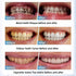 Nano Physical Teeth Cleaning Stick, Teeth Whitening, Cleaning Teeth Smoke Stains, Tartar Stains, Home Oral Care Whitening Teeth Kit, 1+10 Pcs (wit...