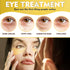 Under Eye Mask, 24 Gold Hydrating Eye Patches, Amino Acid & Collagen Eye Masks For Dark Circles And Puffiness, Women And Man Eye Bags Treatment Fo...