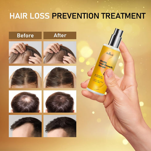 Biotin Hair Growth Serum with Castor Oil, Argan Oil - Hair Loss Prevention Treatment with Hair Regrowth Formula for Women by Beaueli...