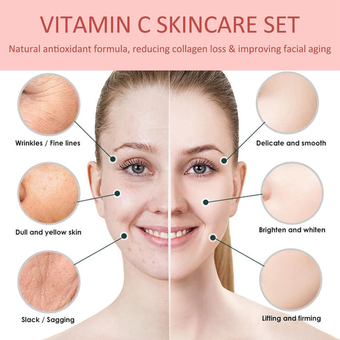 Vitamin C Skin Care Set, 3-In-1 Skincare Gift Set With Facial Cleanser Mousse, Face Serum & Face Cream, Anti-Aging Skin Care Kit With Hyaluronic A...