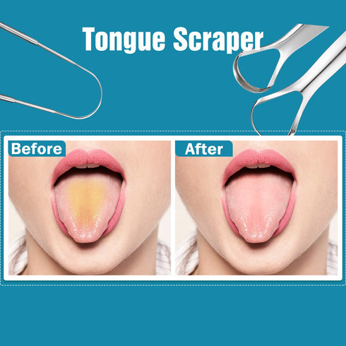 3 PCS Metal Tongue Scraper, Tongue Scrapers for Adults, Stainless Steel Tounge Scrappers, Tounge Scraper, Portable Tongue Scrappers YLYL...