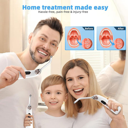 Voraiya Electronic Tonsil Stone Remover Vacuum,10 in 1 Tonsil Stone Removal Kit, 5 Modes Tonsil Stone Cleaner Instant Suction Tool, Easy to Use, F...