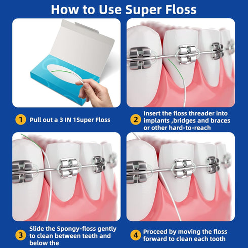 Dental Floss for Braces, Floss Threaders for Bridges and Implants 80 Pre-Cut Strands 80PCS (Pack of 2)...