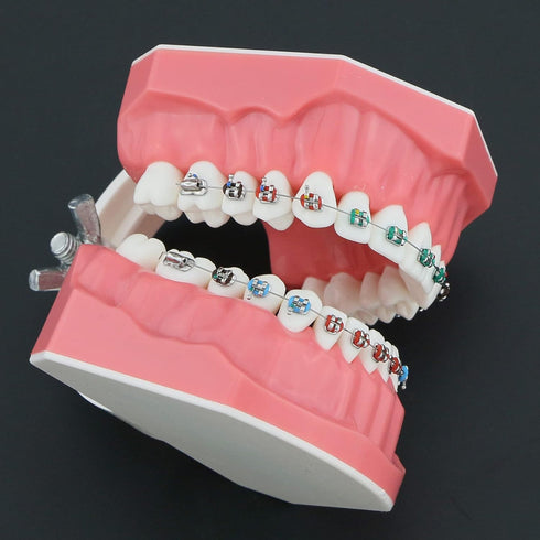 Orthodontic Model Dental Models 1:1 Standard Typodont Teeth Model M7010-2 Demo Teach Study with Archwire Ligature Ties Metal Brackets Buccal Tubes...