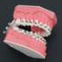 Orthodontic Model Dental Models 1:1 Standard Typodont Teeth Model M7010-2 Demo Teach Study with Archwire Ligature Ties Metal Brackets Buccal Tubes...