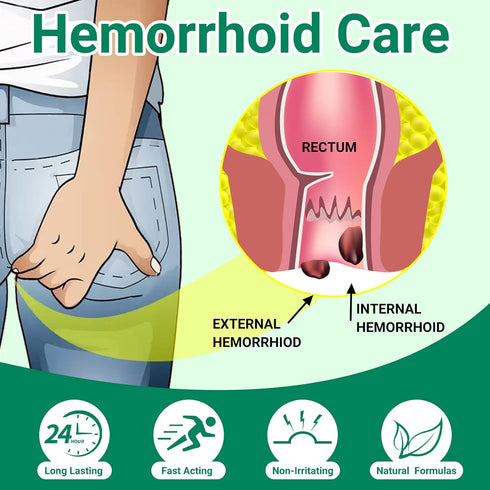 LMNOOP® Hemorrhoid Treatment Ointment, Maximum Strength Treatment & Fast Relief for Pain, Itching, Burning, Swelling, Fissure, Bleeding, Discomfor...