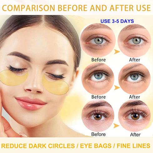 Under Eye Patches, 24K Gold Eye Mask, Eye Patches for Puffy Eyes and Dark Circles Reduce Eye Bags Fine Lines Smooth Wrinkle, Anti-Aging,Hydrating,...