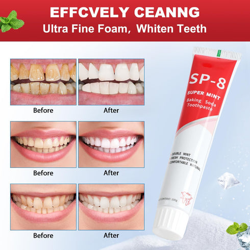 2PCS SP-8 Ultra Whitening Toothpaste,SP-8 Toothpaste,SP 8 Probiotic Toothpaste, Sp8 Probiotic Brightening Toothpaste, Sp-8 Toothpaste Fresh Breath...