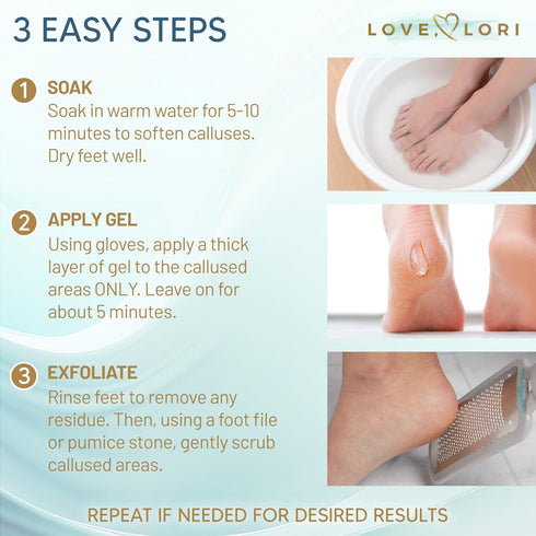 Callus Remover for Feet (Extra Strength) Foot Callus Remover Gel - Feet Scrubber, Pedicure Spa Tools, 6oz...