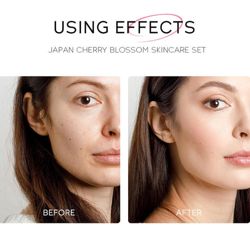 Sakura Face Care Set for Women, 17Pcs Moisturizing Skin Care Set Include Sakura Cream, Cleanser, Serum, Toner, Eye Cream, Lip Mask, Mud Mask, Slee...