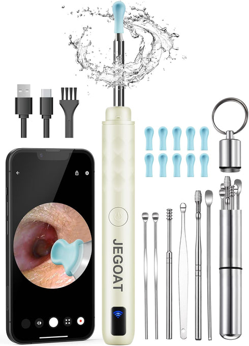Ear Wax Removal Tool Camera, Ear Cleaner with Camera, Ear Cleaning Kit 1296P HD Ear Scope and 6 LED Lights, 10 Ear Pick Tips, Earwax Removal kit w...