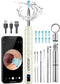 Ear Wax Removal Tool Camera, Ear Cleaner with Camera, Ear Cleaning Kit 1296P HD Ear Scope and 6 LED Lights, 10 Ear Pick Tips, Earwax Removal kit w...