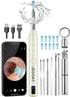 Ear Wax Removal Tool Camera, Ear Cleaner with Camera, Ear Cleaning Kit 1296P HD Ear Scope and 6 LED Lights, 10 Ear Pick Tips, Earwax Removal kit w...