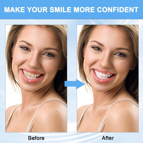 SP-8 Ultra Whitening Toothpaste,SP 8 Probiotic Toothpaste,Sp8 Probiotic Brightening Toothpaste,Sp-8 Toothpaste,Daily Care Toothpaste,Super Deep Cl...
