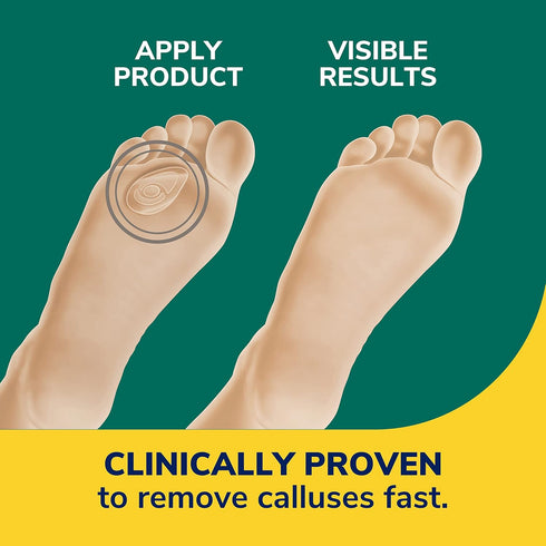 Dr. Scholl's CALLUS REMOVER Seal & Heal Bandage with Hydrogel Technology, 4ct // Removes Calluses Fast And Provides Cushioning Protection Against ...