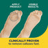 Dr. Scholl's CALLUS REMOVER Seal & Heal Bandage with Hydrogel Technology, 4ct // Removes Calluses Fast And Provides Cushioning Protection Against ...