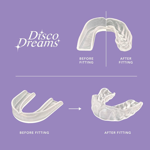 Disco Dreams 2 Pack Customizable Night Guard - Nighttime Relief from Teeth Grinding, at Home Fitting Experience for Nighttime Teeth Grinding & Cle...