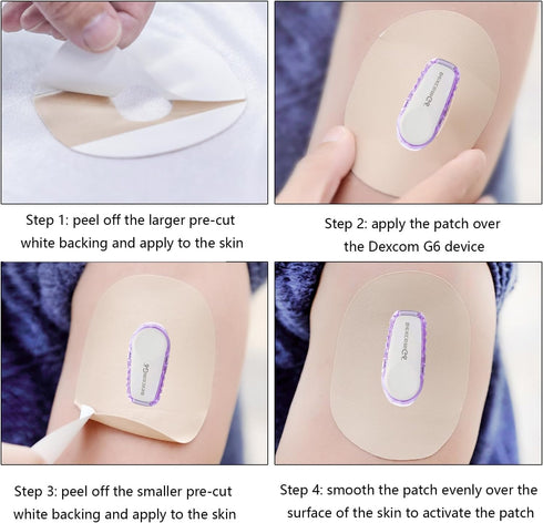 40 Packs Adhesive Patches for Dexcom G6 CGM – Waterproof & Sweatproof Adhesive for Long Stay, Pre-Cut Adhesive Medical Tape, Continuous Glucose Mo...