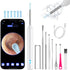 Ear Wax Removal Tool Camera, Ear Cleaner with Camera, Ear Cleaning Kit 1296P HD Ear Scope, 6 LED Lights and 6 Ear Picks, Earwax Removal with Otosc...
