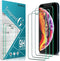 Slanku (3-Pack) Temepered Glass for iPhone 12 Mini 5.4-inch Screen Protector, Easy to Install, Bubbles Free, Case Friendly......