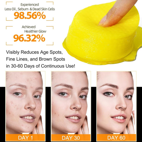 Kojic Acid Turmeric Cleansing Pads, Turmeric Cleansing Exfoliating Pads for Dark Spots, Turmeric Cleansing Pads For Face, Balance Skin Oil And Wat...