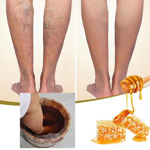 Bee Venom Foot Soak (2 Pack), Bee Venom Lymphatic Drainage Foot Soak, De Tox Foot Soak Beads...