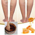 Bee Venom Foot Soak (2 Pack), Bee Venom Lymphatic Drainage Foot Soak, De Tox Foot Soak Beads...